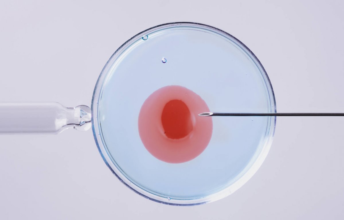 Como funciona a Fertilização in Vitro