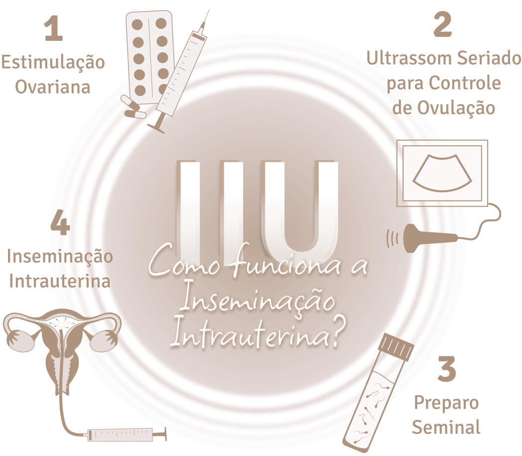 Clínica de Inseminação Artificial Especialista São Paulo SP