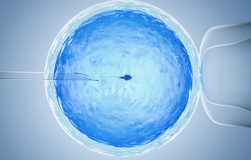Fertilização in vitro melhor clinica