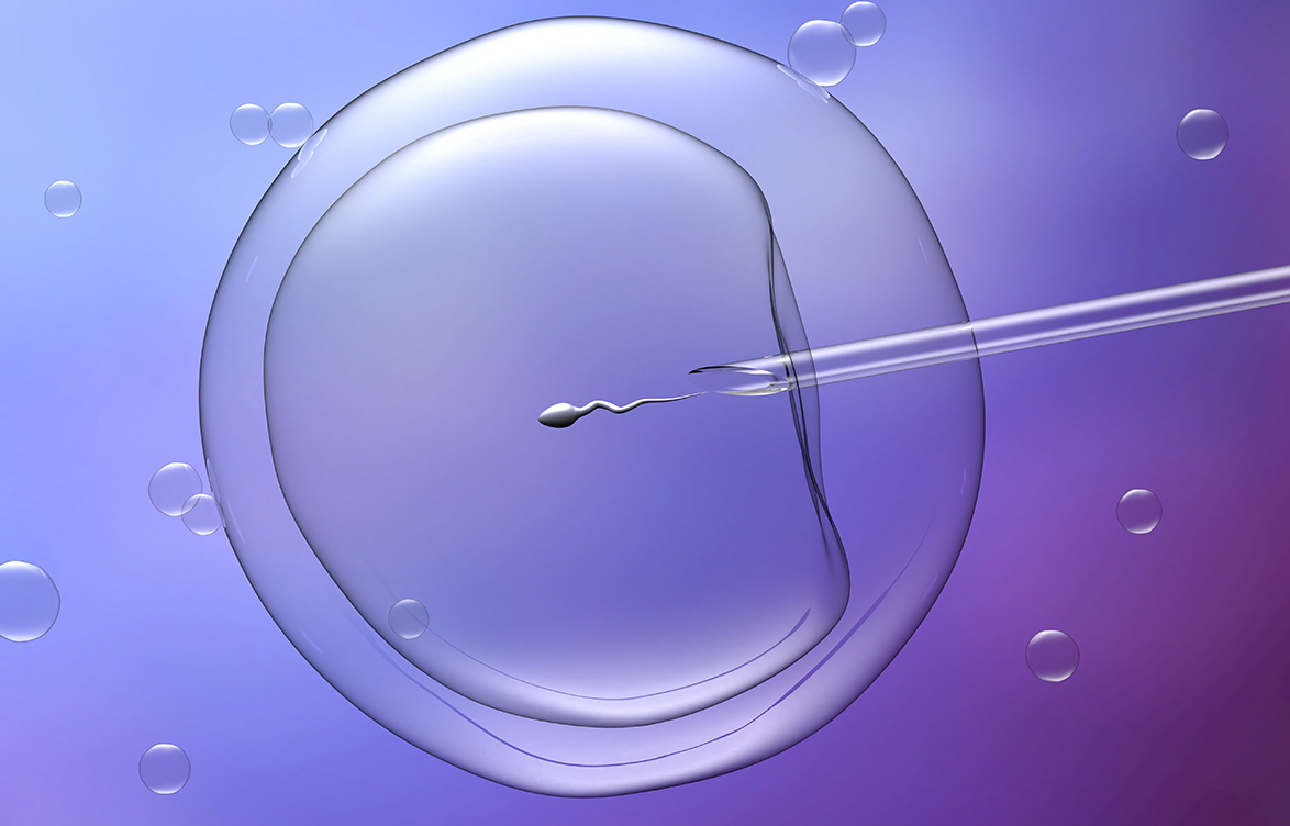 ginecologista especialista em endometriose são paulo