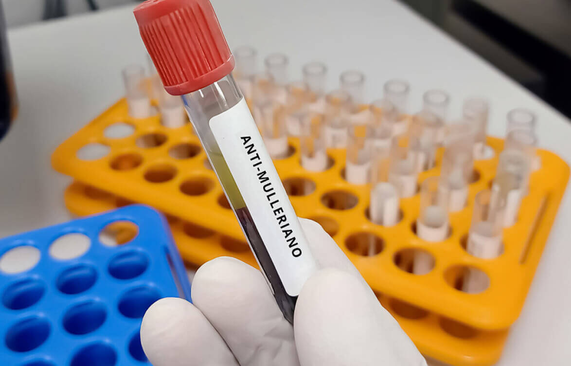 exame de fertilidade feminina feminina